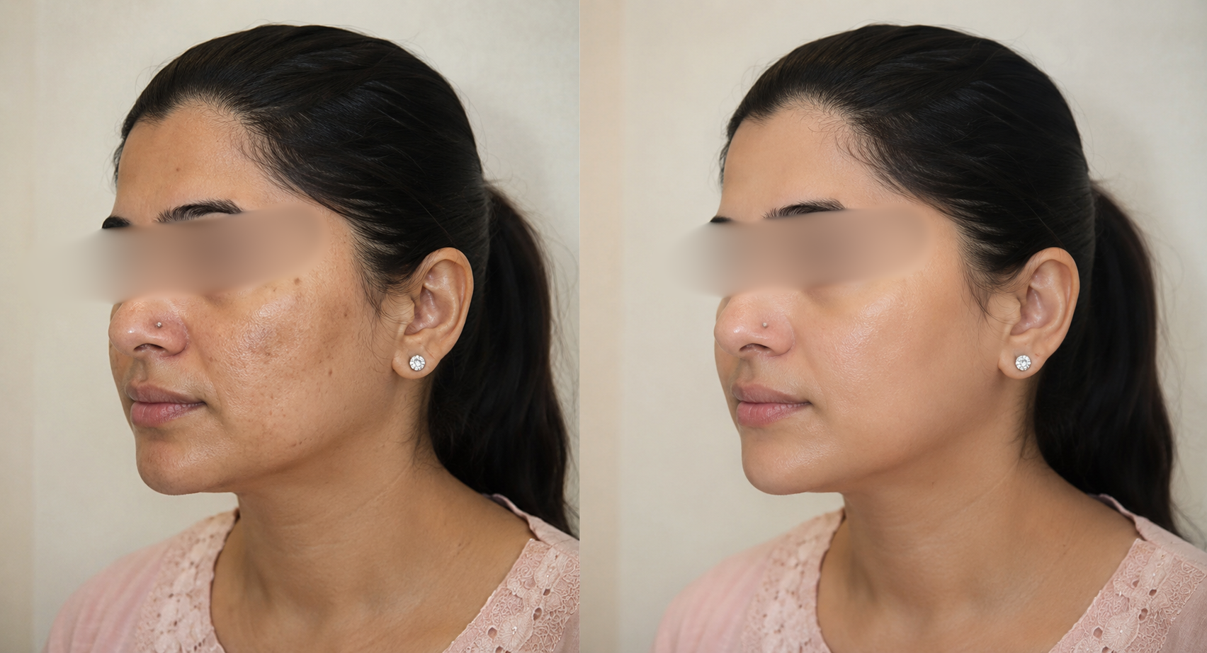 Pigmentation & Glow Therapy